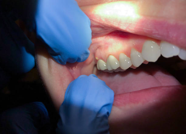 Best Emergency Gum Pain Relief  in De Soto, IA